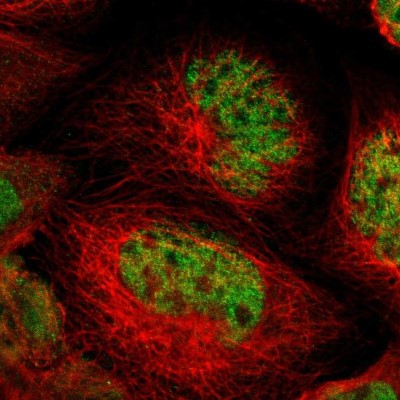 Immunocytochemistry/Immunofluorescence: NFRKB Antibody [NBP1-85095] - Immunofluorescent staining of human cell line A-431 shows localization to nucleus.