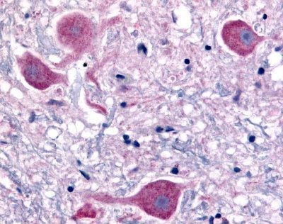 Immunohistochemistry: Neurotensin Receptor 2 Antibody [NLS3747] - Analysis of anti-NTSR2 / NTR2 antibody with brain, neurons at 4 ug/ml.
