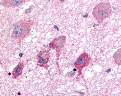 Immunohistochemistry-Paraffin: Neurotensin Receptor 2 Antibody [NLS3747] - Analysis of anti-NTSR2 / NTR2 antibody with brain, neurons.