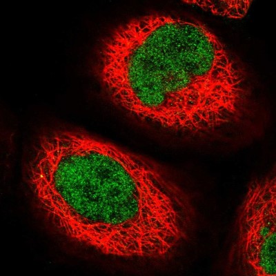 Immunocytochemistry/Immunofluorescence: CIB3 Antibody [NBP1-91786] - Staining of human cell line A-431 shows positivity in nucleus but not nucleoli.