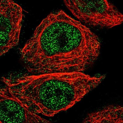 Immunocytochemistry/Immunofluorescence: EVORF Antibody [NBP1-93723] - Immunofluorescent staining of human cell line A-431 shows localization to nucleus.