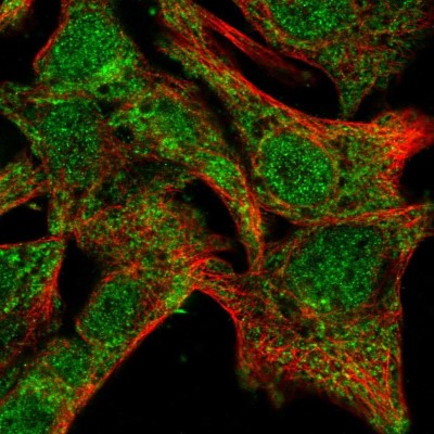 Immunocytochemistry/Immunofluorescence: SDR39U1 Antibody [NBP1-92373] - Immunofluorescent staining of human cell line Hep G2 shows localization to nucleoplasm & cytosol.