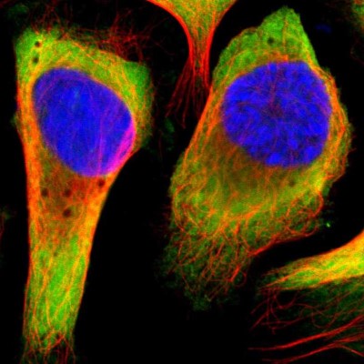 Immunocytochemistry/Immunofluorescence: RPL14 Antibody [NBP1-85385] - Immunofluorescent staining of human cell line U-2 OS shows localization to cytosol & endoplasmic reticulum.