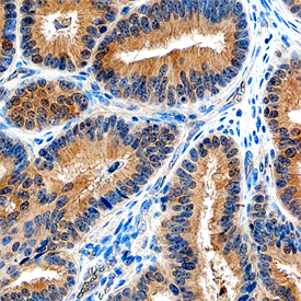 SHARPIN was detected in immersion fixed paraffin-embedded sections of human ovary using Sheep Anti-Human SHARPIN Antigen Affinity-purified Polyclonal Antibody (Catalog # AF8100) at 10 µg/mL overnight at 4 °C. Tissue was stained using the Anti-Sheep HRP-DAB Cell & Tissue Staining Kit (brown; Catalog # CTS019) and counterstained with hematoxylin (blue). Specific staining was localized to cytoplasm. View our protocol for Chromogenic IHC Staining of Paraffin-embedded Tissue Sections.