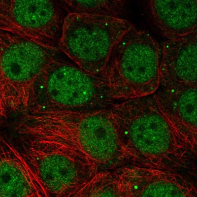 Immunocytochemistry/Immunofluorescence: NSMCE1 Antibody [NBP1-92201] - Immunofluorescent staining of human cell line MCF7 shows localization to nucleoplasm & vesicles.