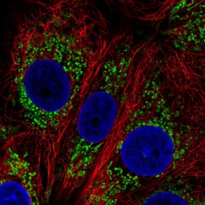 Immunocytochemistry/Immunofluorescence: DHTKD1 Antibody [NBP2-55215] - Staining of human cell line MCF7 shows localization to mitochondria.
