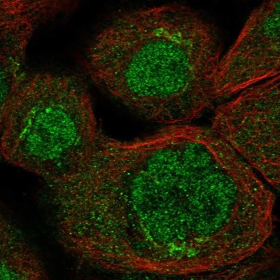Immunocytochemistry/Immunofluorescence: RASSF6 Antibody [NBP2-55145] - Staining of human cell line A-431 shows localization to nucleoplasm & the Golgi apparatus.
