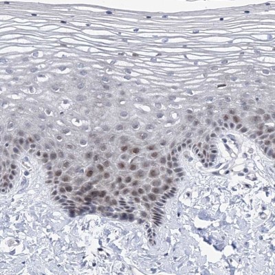 Immunocytochemistry/Immunofluorescence: NUFIP1 Antibody [NBP1-82515] - Staining of human vagina shows nuclear positivity in squamous epithelial cells.