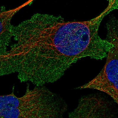 Immunocytochemistry/Immunofluorescence: NHE3/SLC9A3 Antibody [NBP1-82575] - Immunofluorescent staining of human cell line U-2 OS shows localization to plasma membrane.