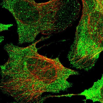 Immunocytochemistry/Immunofluorescence: GPR63 Antibody [NBP1-82362] - Staining of human cell line U-2 OS shows localization to nucleus, plasma membrane & cytosol.