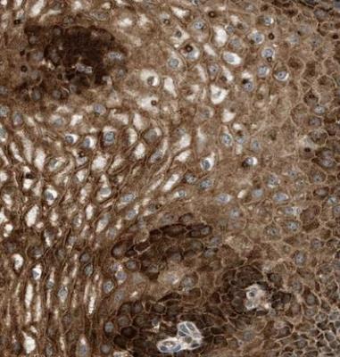 Immunohistochemistry-Paraffin: C7orf43 Antibody [NBP1-83808] - Staining of human esophagus shows strong cytoplasmic positivity in squamous epithelial cells.