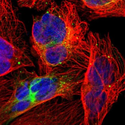 Immunocytochemistry/Immunofluorescence: ZNF132 Antibody [NBP1-80915] - Immunofluorescent staining of human cell line U-2 OS shows localization to intermediate filaments & vesicles.