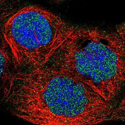 Immunocytochemistry/Immunofluorescence: FBXO11 Antibody [NBP1-84712] - Staining of human cell line A-431 shows positivity in nucleus and nucleoli.