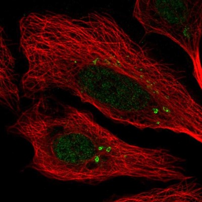 Immunocytochemistry/Immunofluorescence: CCDC46 Antibody [NBP1-84539] - Immunofluorescent staining of human cell line U-2 OS shows localization to nucleoplasm & the Golgi apparatus.