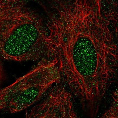 Immunocytochemistry/Immunofluorescence: Lhx8 Antibody [NBP2-57782] - Staining of human cell line A549 shows localization to nucleus, nucleoli & cytosol.