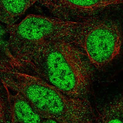 Immunocytochemistry/Immunofluorescence: Aspartate Aminotransferase Antibody [NBP2-57518] - Staining of human cell line U-2 OS shows localization to nucleoplasm & cytosol.
