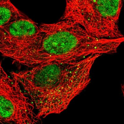 Immunocytochemistry/Immunofluorescence: CLEC16A Antibody [NBP2-57150] - Staining of human cell line A549 shows localization to nucleoplasm & vesicles.