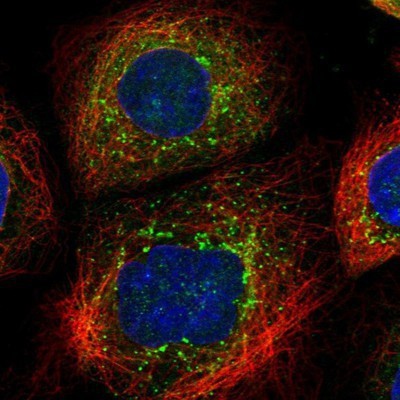 Immunocytochemistry/Immunofluorescence: C6orf1 Antibody [NBP1-90343] - Staining of human cell line A-431 shows positivity in vesicles.