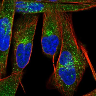 Immunocytochemistry/Immunofluorescence: C6orf1 Antibody [NBP1-90343] - Immunofluorescent staining of human cell line RH-30 shows localization to vesicles.