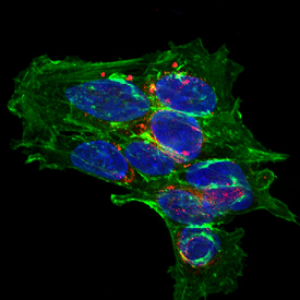 SH‑SY5Y human neuroblastoma cells were cultured overnight in the presence of 1 mM Retinoic Acid (Catalog # 0695/50) prior to immersion fixation. Complexin-2 was detected using a Goat Anti-Human/Mouse/Rat Complexin-2 Antigen Affinity-purified Polyclonal Antibody (Catalog # AF5085). The cells were stained with the NorthernLights 557-conjugated Donkey Anti-Goat IgG Affinity-purified Secondary Antibody (red; Catalog # NL001). Actin filaments were stained with FITC-conjugated Phalloidin (green) and the nuclei were counterstained with DAPI (blue). Complexin-2 immunoreactivity was localized to synaptic vesicles. View our protocol for Fluorescent ICC Staining of Cells on Coverslips.