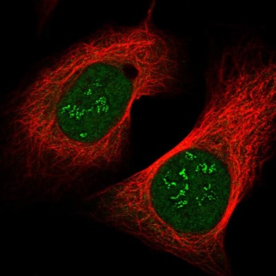 Immunocytochemistry/Immunofluorescence: CHCHD8 Antibody [NBP1-90483] - Immunofluorescent staining of human cell line U-2 OS shows localization to nucleoplasm & nucleoli fibrillar center.