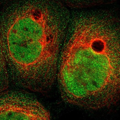 Immunocytochemistry/Immunofluorescence: ABHD15 Antibody [NBP1-91100] - Immunofluorescent staining of human cell line A-431 shows localization to nucleoplasm & cytosol.