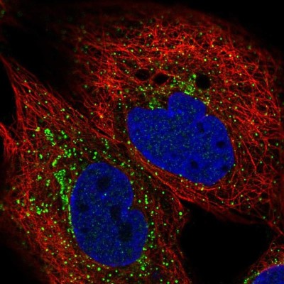 Immunocytochemistry/Immunofluorescence: SLC23A2 Antibody [NBP2-57176] - Staining of human cell line A-431 shows localization to the Golgi apparatus & vesicles.