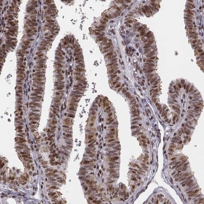 Immunocytochemistry/Immunofluorescence: LUC7L Antibody [NBP2-56401] - Immunohistochemical staining of human fallopian tube shows nuclear positivity in glandular cells.