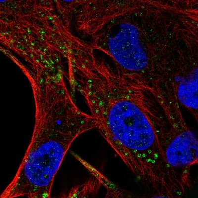 Immunocytochemistry/Immunofluorescence: FIG4 Antibody [NBP2-56977] - Staining of human cell line SK-MEL-30 shows localization to vesicles & lipid droplets.