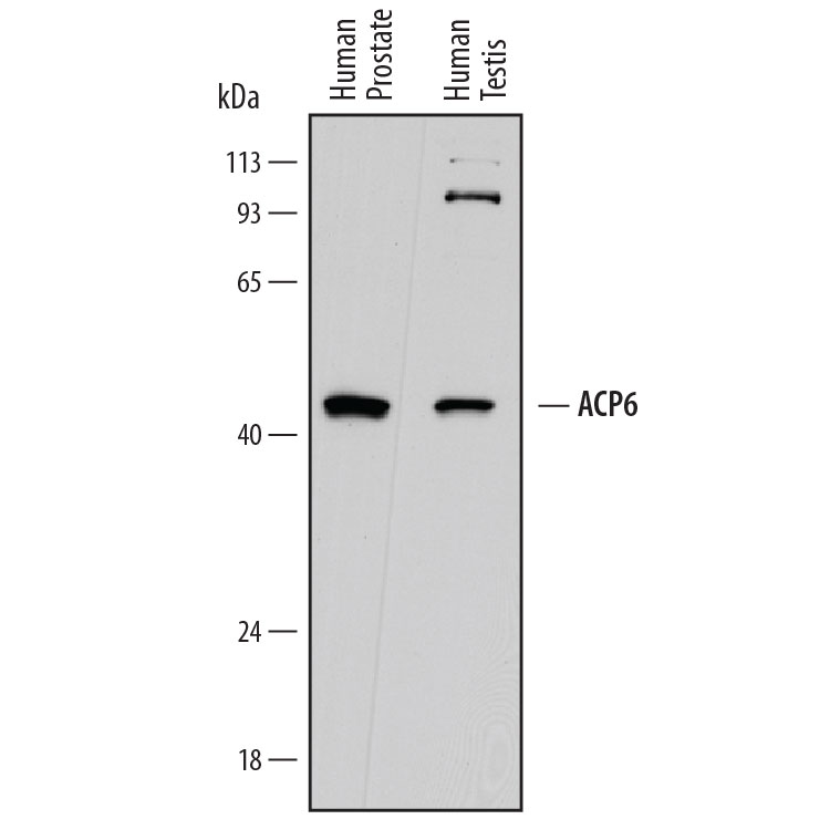 Western blot shows lysates of human prostate tissue and human testis tissue. PVDF membrane was probed with 1 µg/mL of Sheep Anti-Human ACP6 Antigen Affinity-purified Polyclonal Antibody (Catalog # AF7766) followed by HRP-conjugated Anti-Sheep IgG Secondary Antibody (Catalog # HAF016). A specific band was detected for ACP6 at approximately 44 kDa (as indicated). This experiment was conducted under reducing conditions and using Immunoblot Buffer Group 1.