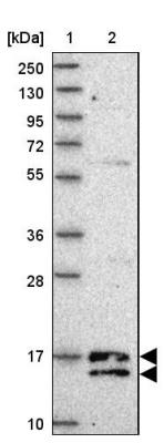 Western Blot: C19orf25 Antibody [NBP2-14391] - Lane 1: Marker  [kDa] 250, 130, 95, 72, 55, 36, 28, 17, 10.  Lane 2: Human cell line RT-4