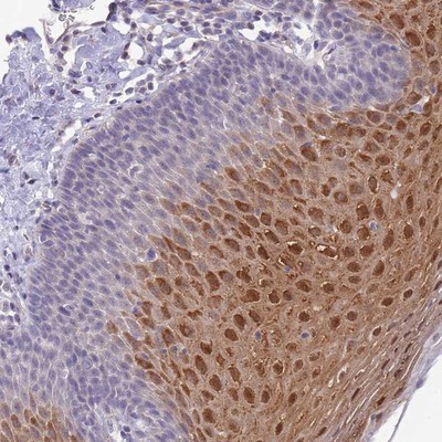Immunohistochemistry-Paraffin: C19orf25 Antibody [NBP2-14391] - Staining of human esophagus shows strong nuclear and cytoplasmic positivity in superficial cells of squamous epithelia.