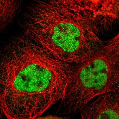 Immunocytochemistry/Immunofluorescence: MYOM1 Antibody [NBP1-86460] - Staining  of human cell line A-431 shows positivity in nuclei but not nucleoli.