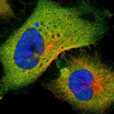 Immunocytochemistry/Immunofluorescence: PNCK Antibody [NBP1-86652] - Immunofluorescent staining of human cell line U-251 MG shows localization to plasma membrane & cytosol.