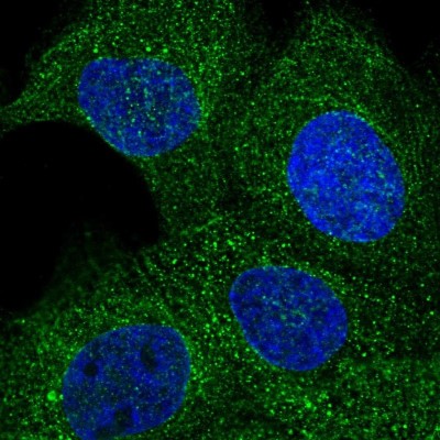 Immunocytochemistry/Immunofluorescence: NAT9 Antibody [NBP1-85088] - Staining of human cell line A-431 shows positivity in cytoplasm.