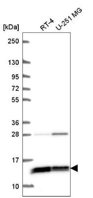 Western Blot: C19orf56 Antibody [NBP2-55905] - Western blot analysis in human cell line RT-4 and human cell line U-251 MG.