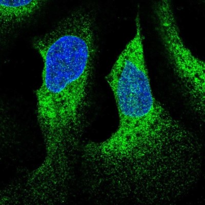 Immunocytochemistry/Immunofluorescence: C19orf56 Antibody [NBP2-55905] - Staining of human cell line U-2 OS shows localization to nuclear membrane & endoplasmic reticulum.