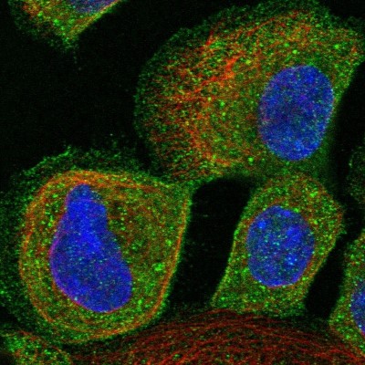 Immunocytochemistry/Immunofluorescence: ALS2CR12 Antibody [NBP1-85902] - Immunofluorescent staining of human cell line A-431 shows localization to plasma membrane & cytosol.