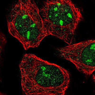 Immunocytochemistry/Immunofluorescence: Tryptophan rich protein Antibody [NBP1-84492] - Staining of human cell line A-431 shows positivity in nucleus and nucleoli.