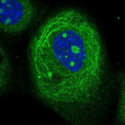 Immunocytochemistry/Immunofluorescence: DEFB119 Antibody [NBP1-84280] - Staining of human cell line A-431 shows positivity in nucleoli, cytoplasm and cytoskeleton (intermediate filaments).