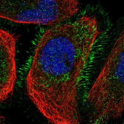 Immunocytochemistry/Immunofluorescence: CCNYL1 Antibody [NBP1-91769] - Immunofluorescent staining of human cell line A-431 shows localization to plasma membrane.