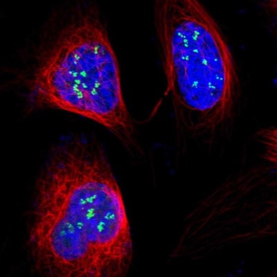 Immunocytochemistry/Immunofluorescence: GGT5 Antibody [NBP1-81833] - Staining of human cell line U-2 OS shows localization to nucleoli fibrillar center.
