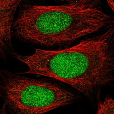 Immunocytochemistry/Immunofluorescence: DPPA2 Antibody [NBP1-85426] - Immunofluorescent staining of human cell line U-2 OS shows localization to nucleus.
