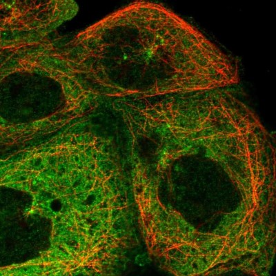 Immunocytochemistry/Immunofluorescence: SPAG9 Antibody [NBP1-85393] - Immunofluorescent staining of human cell line A-431 shows localization to cytosol & microtubule organizing center.