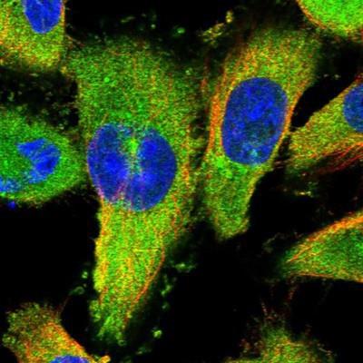 Immunocytochemistry/Immunofluorescence: SPAG9 Antibody [NBP1-85393] - Staining of human cell line U-251 MG shows positivity in cytoplasm.