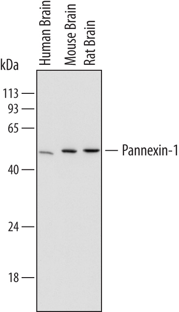 Western blot shows lysates of human brain tissue, mouse brain tissue, and rat brain tissue. PVDF membrane was probed with 1 µg/mL of Mouse Anti-Human/Mouse/Rat Pannexin‑1 Monoclonal Antibody (Catalog # MAB7097) followed by HRP-conjugated Anti-Mouse IgG Secondary Antibody (Catalog # HAF007). A specific band was detected for Pannexin‑1 at approximately 48 kDa (as indicated). This experiment was conducted under reducing conditions and using Immunoblot Buffer Group 1.