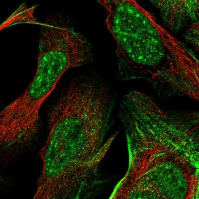 Immunocytochemistry/Immunofluorescence: FCP1 Antibody [NBP1-84704] - Staining of human cell line U-2 OS shows localization to nuclear speckles & actin filaments.