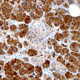Reg1A was detected in immersion fixed paraffin-embedded sections of human pancreas using Sheep Anti-Human Reg1A Antigen Affinity-purified Polyclonal Antibody (Catalog # AF4937) at 3 µg/mL overnight at 4 °C. Before incubation with the primary antibody, tissue was subjected to heat-induced epitope retrieval using Antigen Retrieval Reagent-Basic (Catalog # CTS013). Tissue was stained using the Anti-Sheep HRP-DAB Cell & Tissue Staining Kit (brown; Catalog # CTS019) and counterstained with hematoxylin (blue). Specific staining was localized to cytoplasm in exocrine cells. View our protocol for Chromogenic IHC Staining of Paraffin-embedded Tissue Sections.