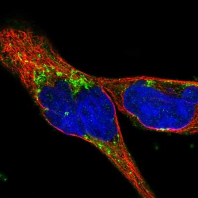 Immunocytochemistry/Immunofluorescence: WFDC1 Antibody [NBP1-87207] - Staining of human cell line A-431 shows positivity in mitochondria.