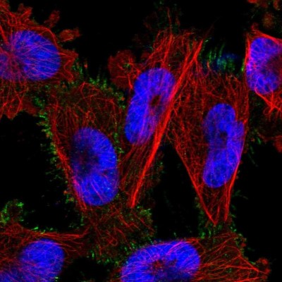 Immunocytochemistry/Immunofluorescence: PARP6 Antibody [NBP1-87333] - Immunofluorescent staining of human cell line U-251 MG shows localization to plasma membrane.